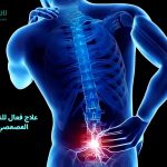 الناسور العصعصي