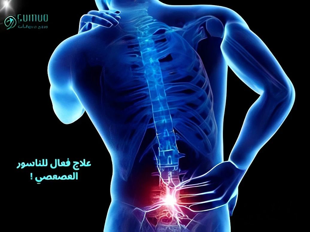 الناسور العصعصي