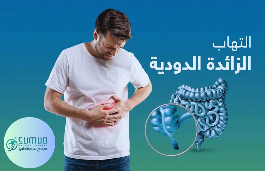 عملية الزائدة - عملية الزايدة - عملية الزائدة الدودية