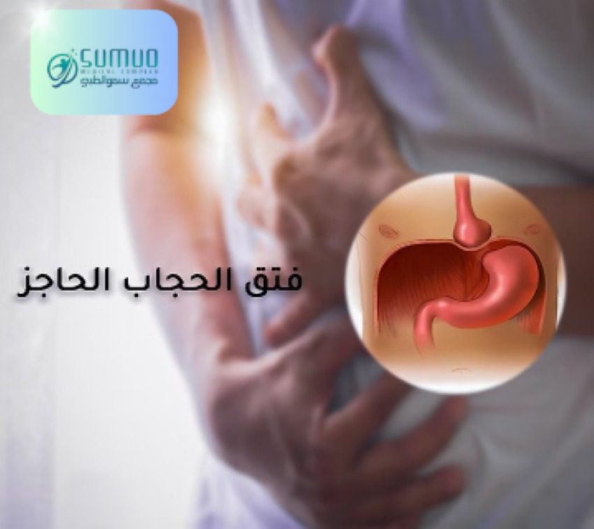فتق الحجاب الحاجز